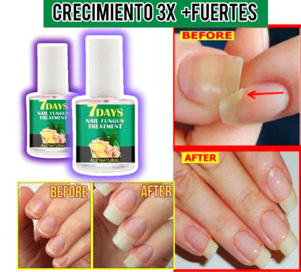 REPARADOR TOTAL DE UÑAS EN 7 DÍAS